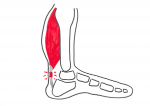 ankelsmerter Smerter i læggen - Akillesenebetændelse overbelastningsskade i ankel og fod smerter på bagsiden af anklen
