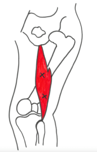Triggerpunkter på bagsiden af hoften
