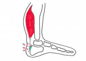 Øvelser for slimsækkebetændelse i anklen : Smerter bag på ankel