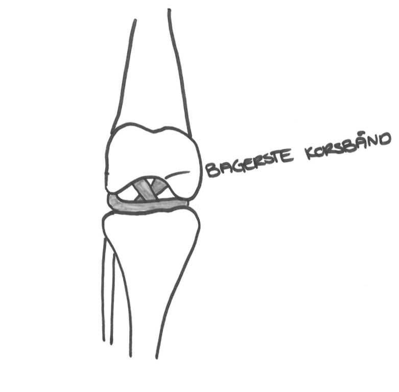 Smerter på bagsiden af knæet